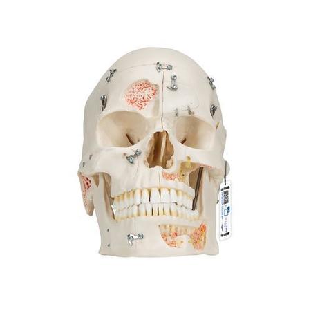 3B SCIENTIFIC Deluxe Demonstration Skull, Dental Skull, 10 part, w/ 3B Smart Anatomy 1000059